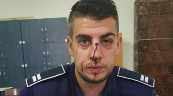 un politist s a ales nu nasul spart dupa ce a fost batut de un sofer beat