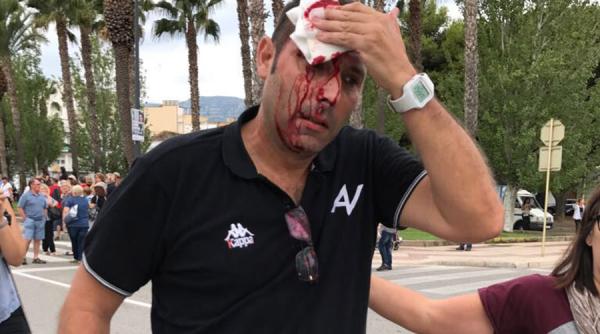 video catalonia 38 de persoane ranite dupa interventia in forta a politiei spaniole