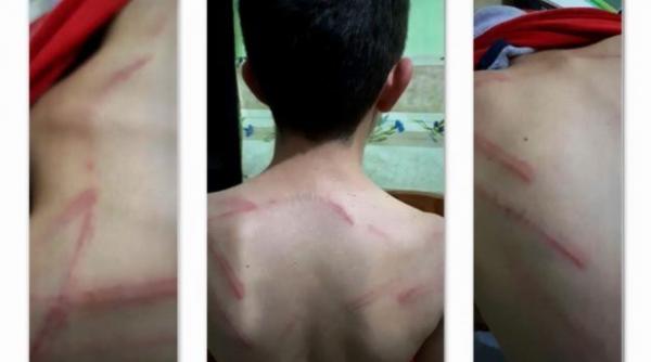 arad copil de 9 ani batut cu cruzime de tatal sau aflat in stare de ebrietate