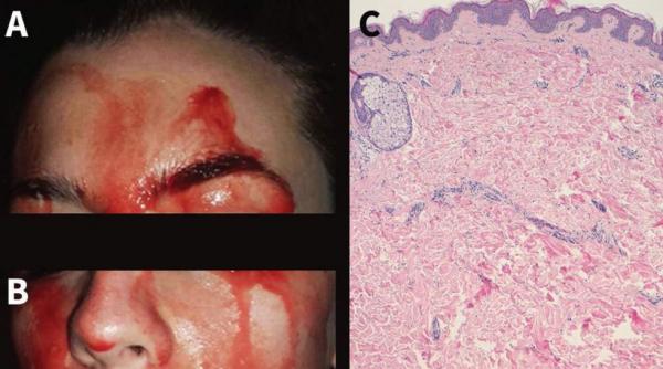 medicii din canada uimiti de simptomele unei paciente din italia