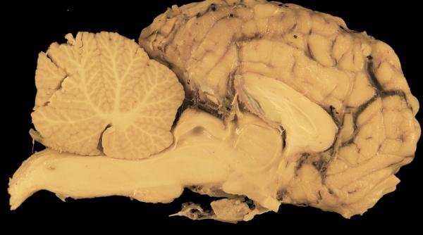 rezerva dfe capacitate a organelor