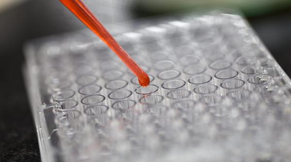 criza de imunoglobulina si nepasarea statului