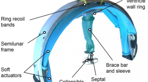 robotul care nu permite inimii sa se opreasca