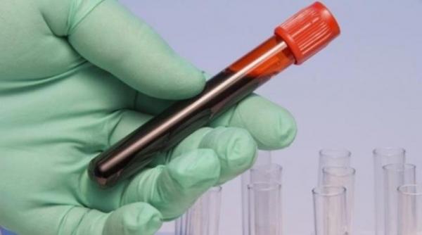 ministerul sanatatii 900 de doze de imunoglobulina vor fi directionate la spitalele unde exista urgente