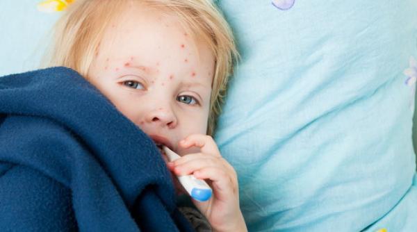 bilant ingrijorator numarul cazurilor de rujeola confirmate a ajuns la 10 307