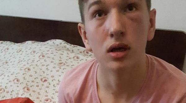 inca un caz in care un elev este batut in scoala de un parinte