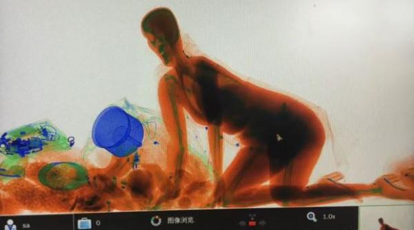 ce a patit o femeie care nu a vrut nici in ruptul capului sa de drumul posetei