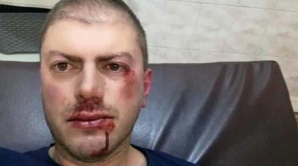 video un barbat a fost lovit crunt de un interlop intr un local din borsa