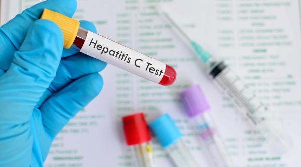 analize gratuite pentru hepatita din aprilie