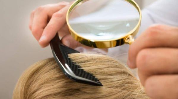 sfaturi pentru frumusete cum sa scapi de matreata in mod natural