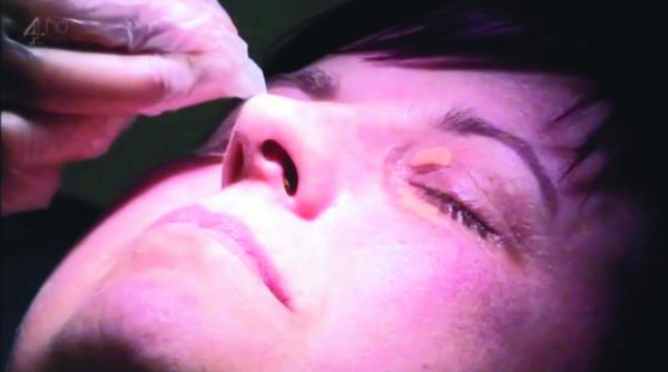 afectiuni semnalate pe pleoape