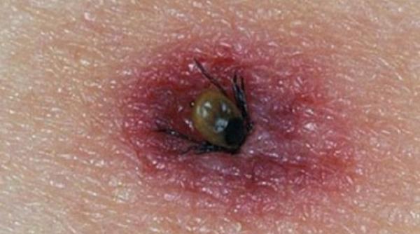 ce trebuie sa faci ca sa te feresti de capuse 6 sfaturi foarte importante