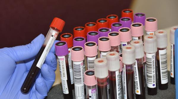 un nou tratament care isi doreste sa fie mult mai eficient in lupta impotriva cancerului