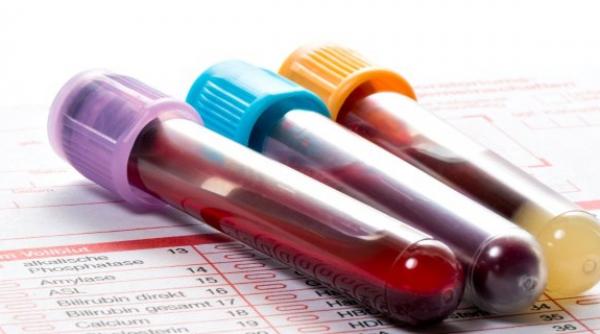 vesti bune de la ministerul sanatatii 12 000 de doze de imunoglobulina vor fi aduse in romania in luna mai