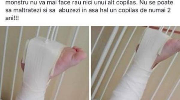un copil de doi ani a ajuns la spital cu fractura de femur dupa ce ar fi fost agresat la gradinita