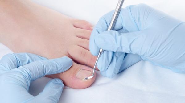 ai fost diagnosticat cu diabet iata care sunt semnalele de alarma trimise de piciorul tau