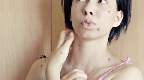 ce este si cum se trateaza acarophobia afla tot ce trebuie sa stii