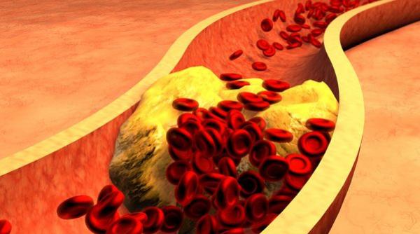 dieta saraca in carbohidrati reduce rigiditatea arterelor la femei