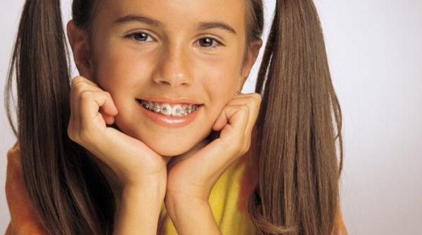 vouchere de pana la 990 de lei pentru aparate ortodontice fixe destinate copiilor
