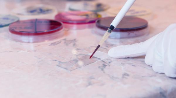 avertismentul medicilor carenta de fier boala grava dar ignorata