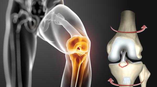 leziunea de ligament incrucisat anterior cum o tratam video 1
