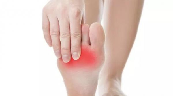 metatarsalgia boala care ti da foc la talpi diagnostic si tratament