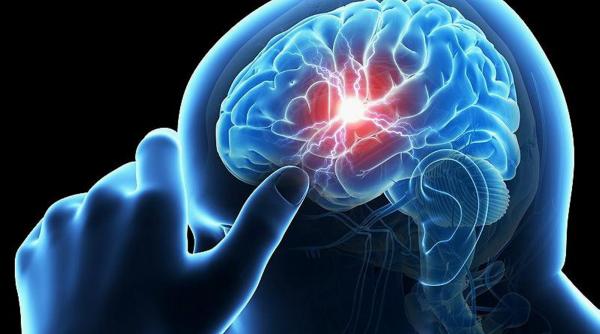 tratament salvator pentru pacientii cu avc