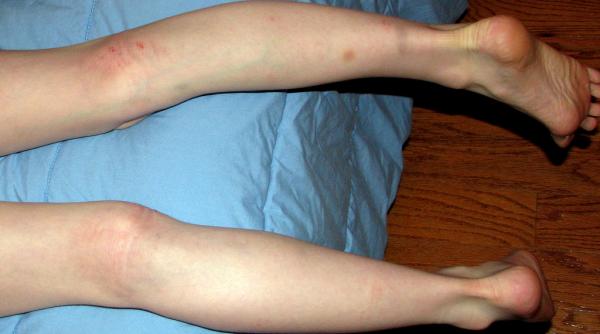 un top model a fost batuta de fostul iubit timp de doi ani