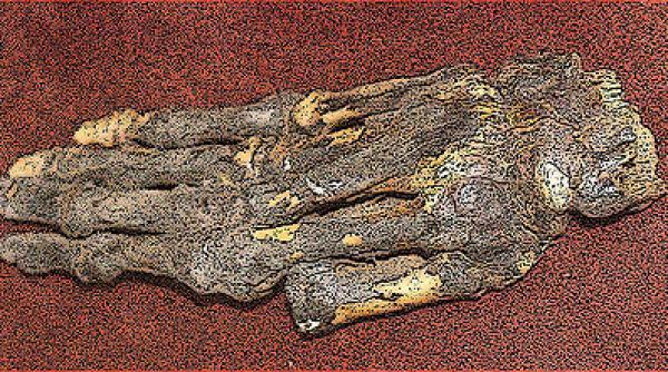 un corp conservat perfect timp de 450 de ani ar putea ajuta la vindecarea artritei