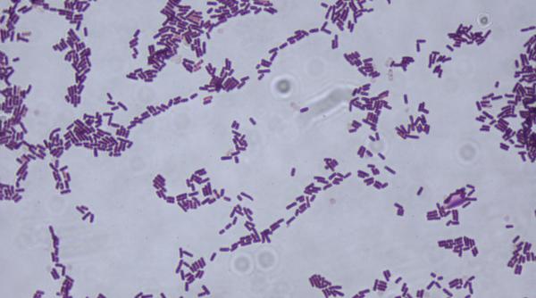 oamenii de stiinta au descoperit un nou mod prin care bacteriile supravietuiesc in fata tratamentului
