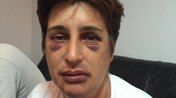 divortati dar impreuna efectele justitiei cu incetinitorul