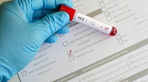 caz infiorator la botosani un barbat a incercat sa infecteze o tanara cu hiv