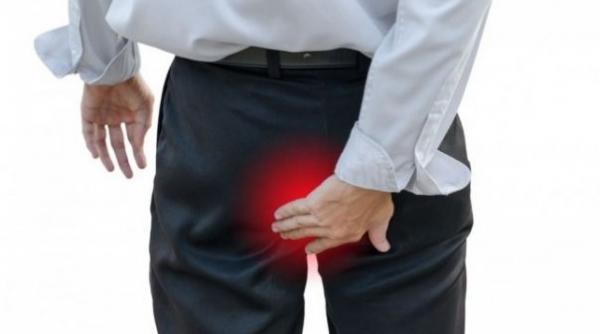 8 metode garantate ca sa scapi de hemoroizi fara operatie 2