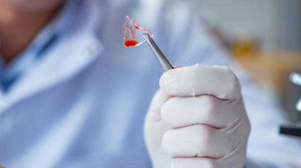 prezervarea fertilitatii inainte de tratamentele oncologice 1