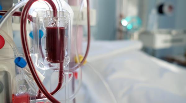 dializa fara aparat metoda a fost inventata de un roman dar niciodata aplicata in practica 1