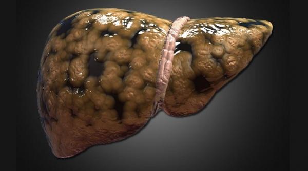 7 sfaturi pentru detoxifierea ficatului