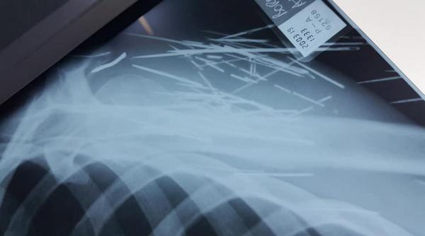 devorator de cuie descoperit la botosani