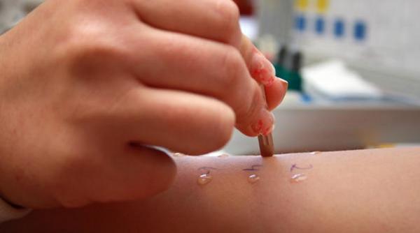 parintii cer analize gratuite pentru copiii cu alergii