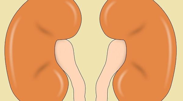 litiaza renala definitie simptomatologie preventie