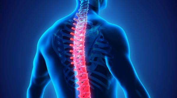 spondilita anchilozanta factorii genetici sunt vinovati diagnostic si tratament