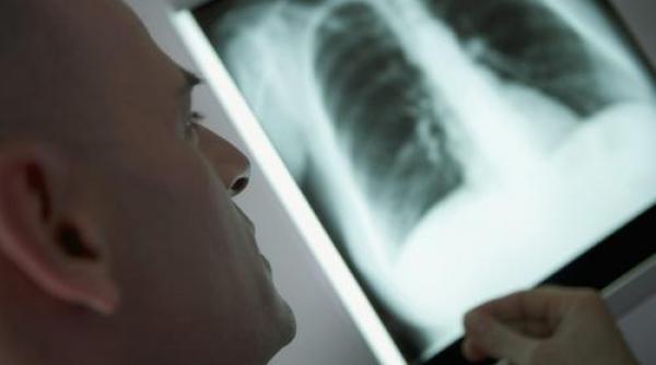 4 3 milioane de euro pentru controlul tbc