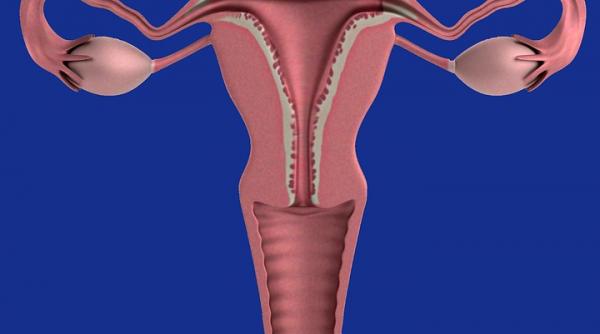 steriletul hormonal sau dispozitivul intra uterin hormonal efecte secundare si contraindicatii