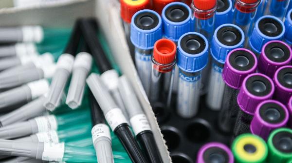 descoperire ingrijoratoare noul coronavirus a evoluat pentru a infecta mai usor celulele umane