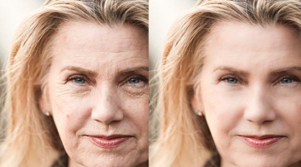 colagen de baut bun pentru pielea ta