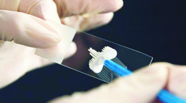 herpesul genital ce e de facut cu virusul hsv