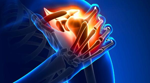 fractura de clavicula nu se repara cu ghips