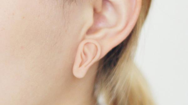 sindromul havana boala diplomatilor din cuba este cauzat de microunde raport