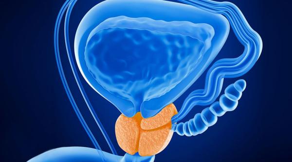 leziunile canceroase in prostata apar la varste tot mai tinere