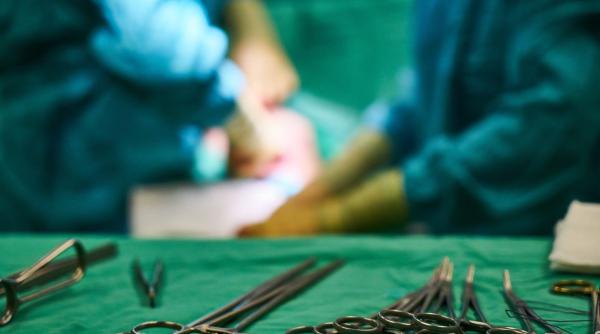 operatii pe banda rulanta care erau o eroare