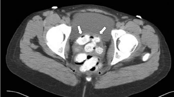 droguri de mare risc transportate ca n filme
